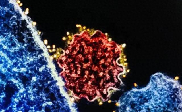 印度突发怪病，类似疫情爆发，致死快还能藏，多国紧张